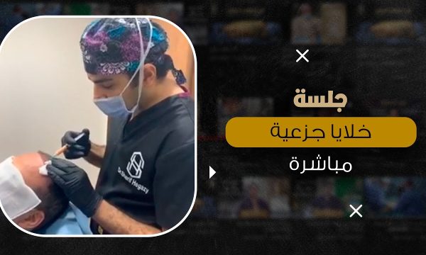 جلسة خلايا جذعية مباشرة