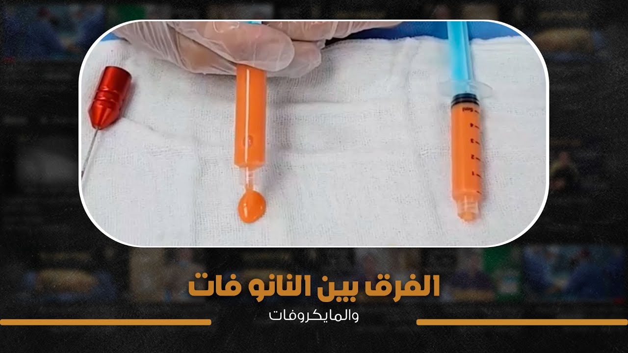 الفرق بين النانو فات والمايكروفات