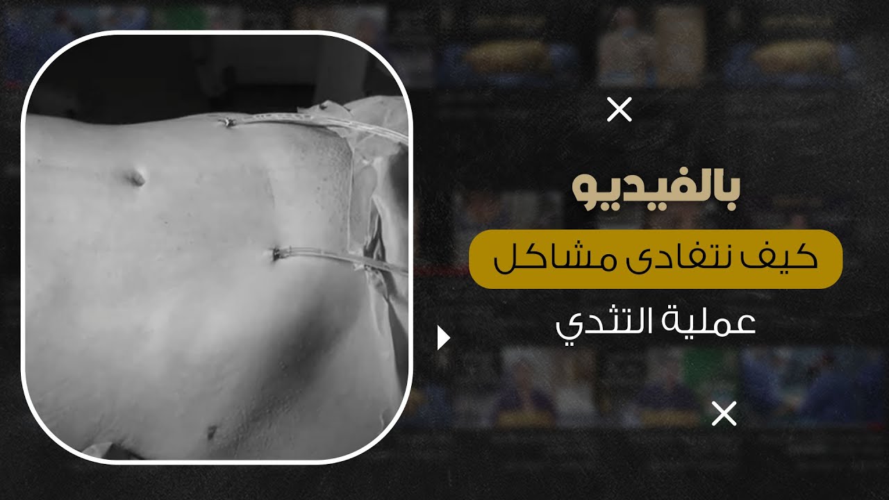 كيف نتفادى مشاكل عملية التثدي
