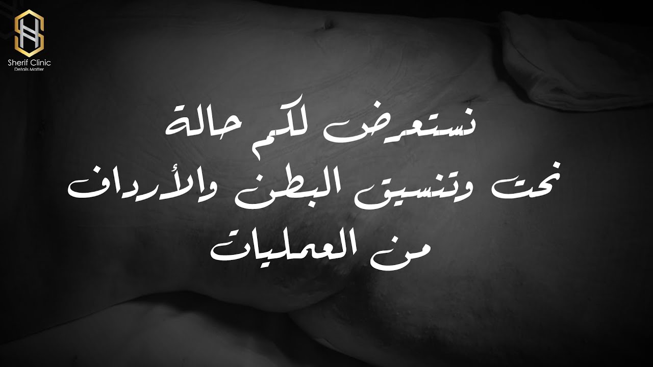 من داخل العمليات وشرح لخطوات عملية شد البطن