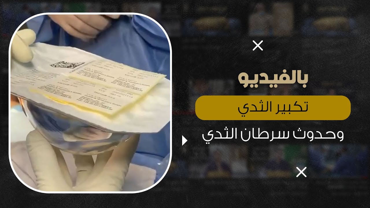 تكبير الثدي وحدوث سرطان الثدي