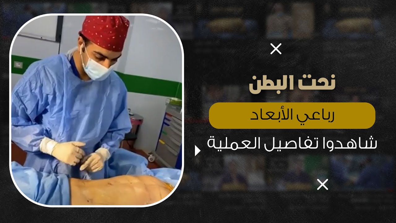 تفاصيل شفط الدهون من غرفة العمليات