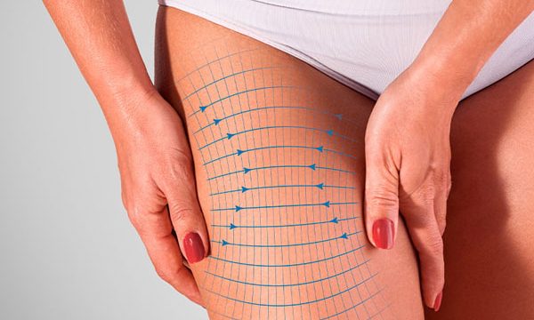 ترهلات الفخذين وأفضل 5 أجهزة مستخدمة