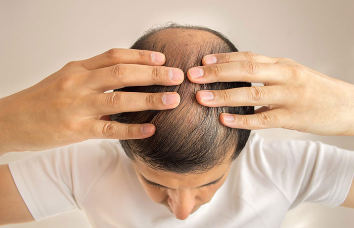 زراعة الشعر الصناعي