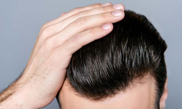 volden بديل زراعة الشعر