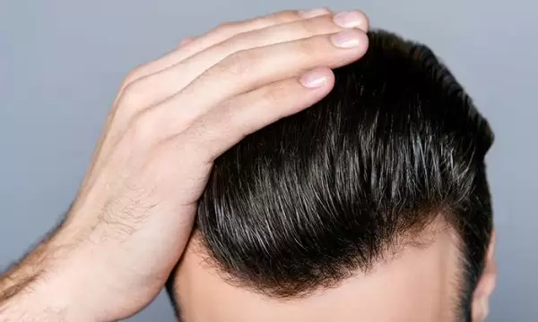 volden بديل زراعة الشعر