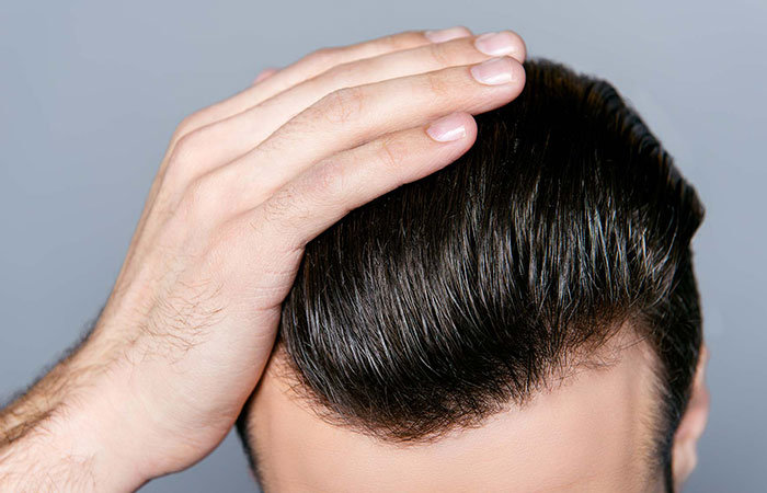 volden بديل زراعة الشعر