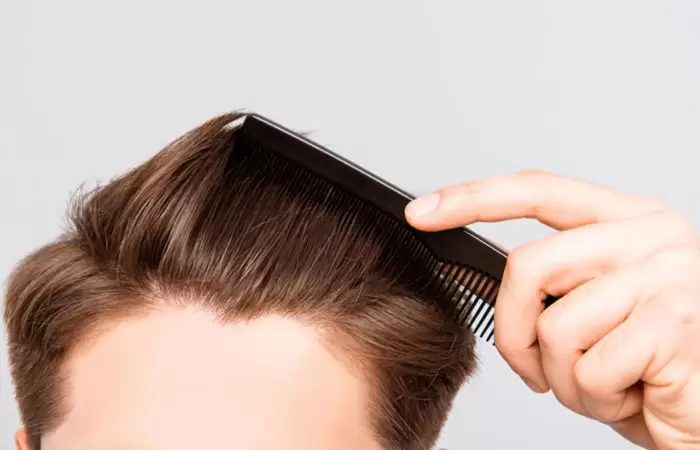 تجربتي مع زراعة الشعر بالصور