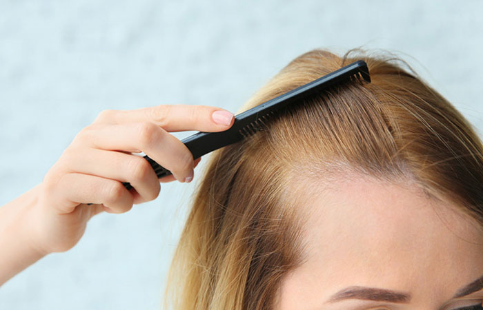 زراعة الشعر للنساء بدون حلاقة