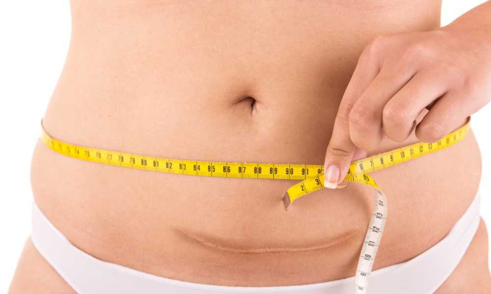 علاج ترهلات البطن بعد القيصرية