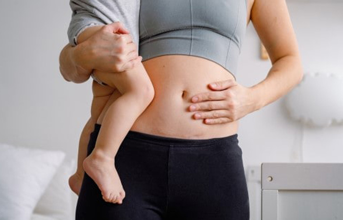 عمليات تجميل الأمومة