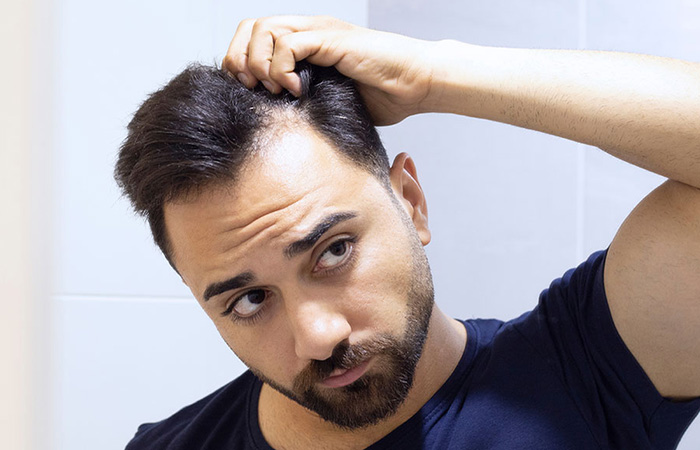 تساقط الشعر المزروع