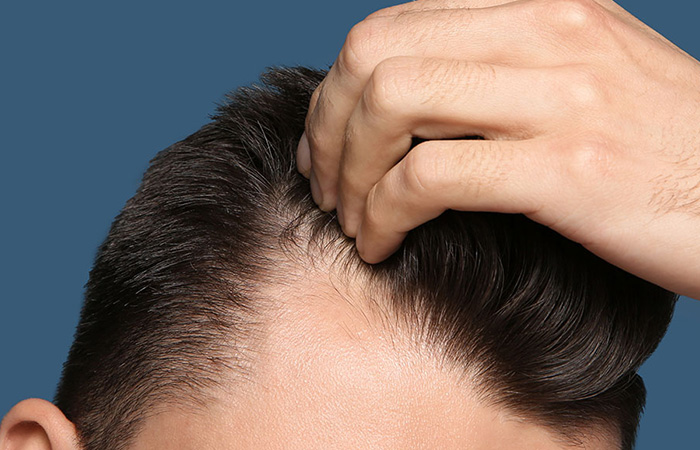 زراعة الشعر من الجسم