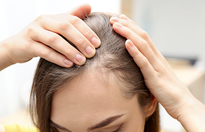 زراعة شعر مقدمة الرأس للنساء