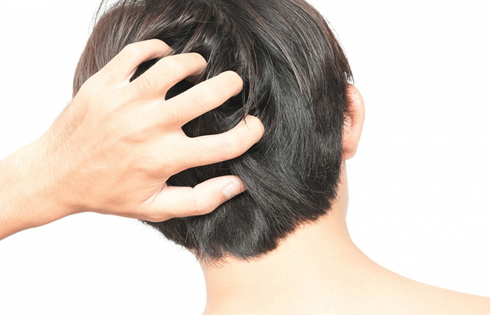 مشاكل زراعة الشعر
