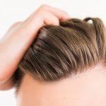 نسبة نجاح زراعة الشعر