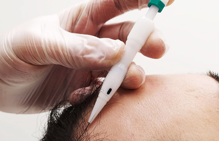 اقلام تشوي لزراعة الشعر