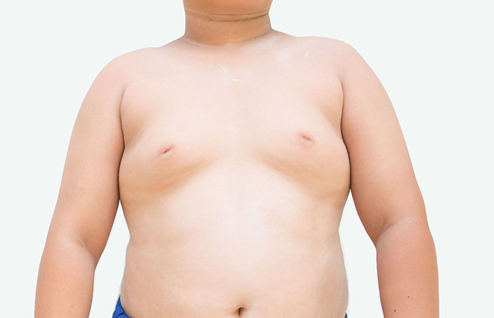 علاج تصغير الثدي عند الرجال بالاعشاب
