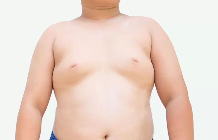 علاج تصغير الثدي عند الرجال بالاعشاب