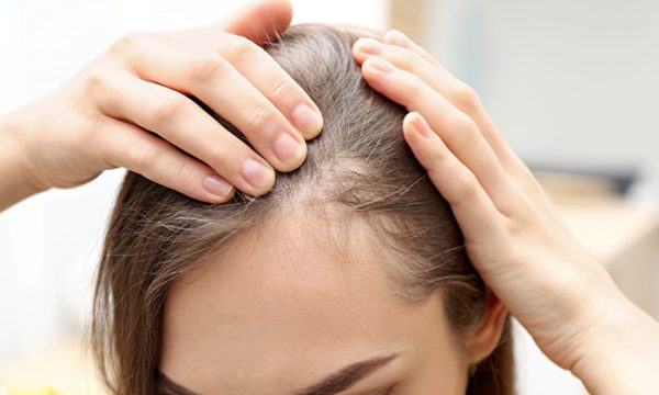 اسباب تساقط الشعر