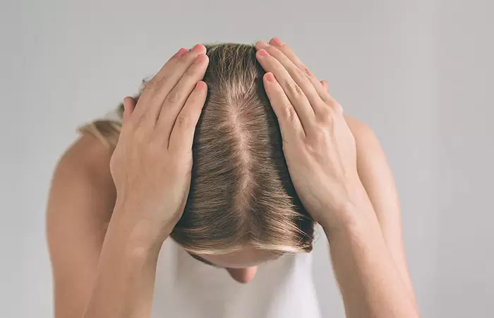 زراعة الشعر للنساء قبل وبعد