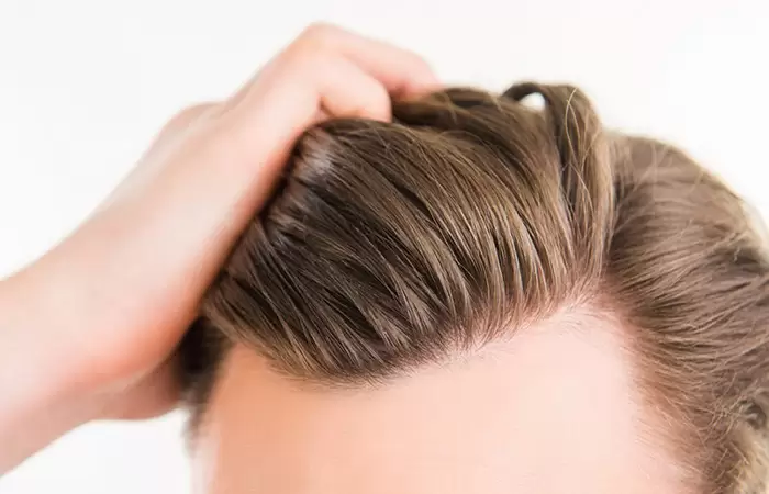 سعر عملية زرع الشعر