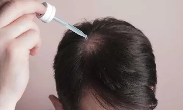 طريقة استخدام مينوكسيديل