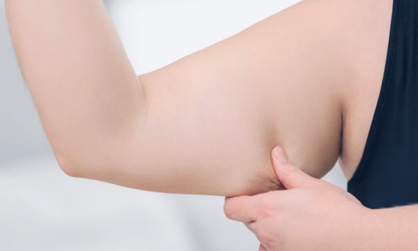 درجات ترهل الذراع