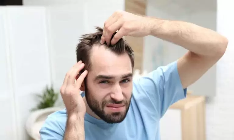 فيناسترايد للشعر