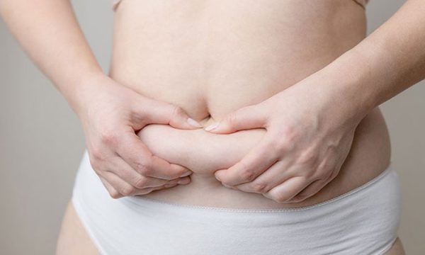 عملية تجميل البطن