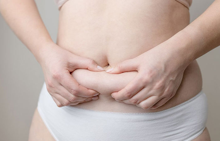 عملية تجميل البطن