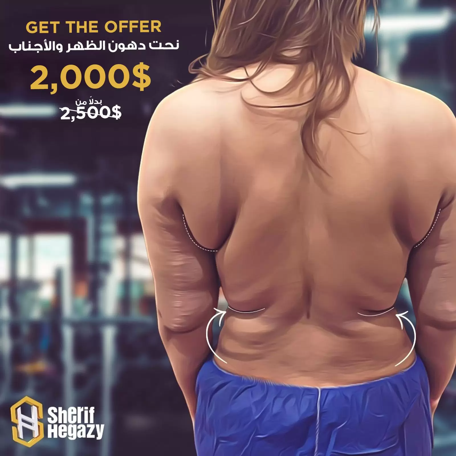 Back offer