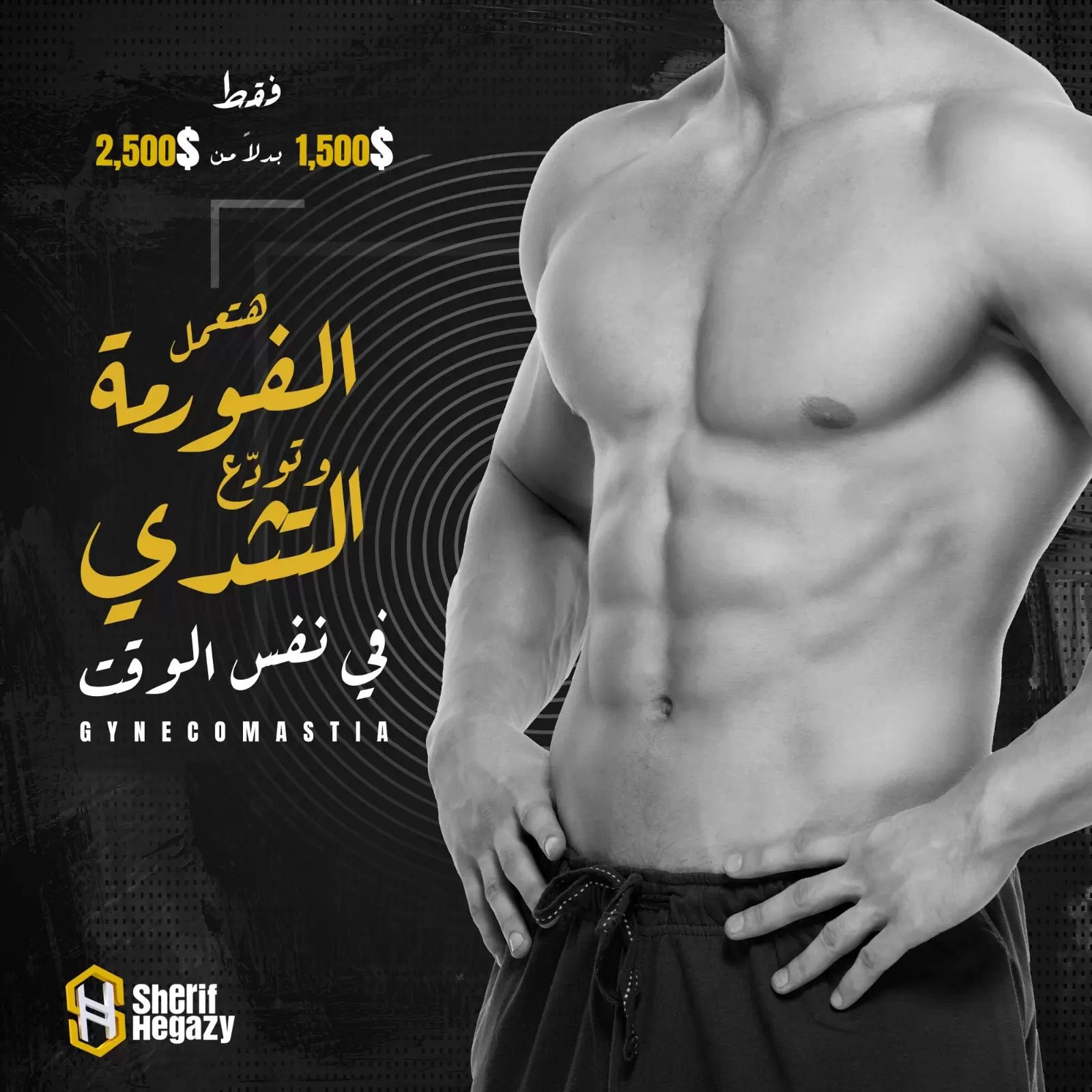 gynecomastia offer