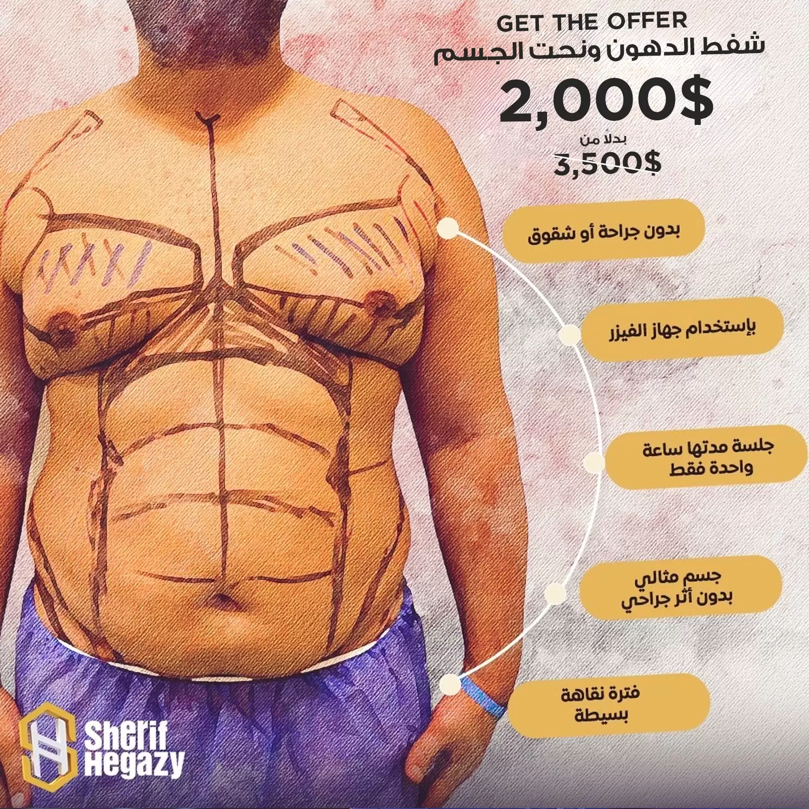 men liposuction offer