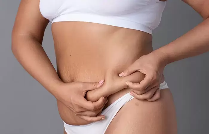 أسعار عملية شد البطن