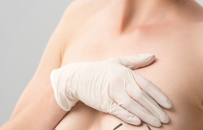 علاج ترهلات الثدى
