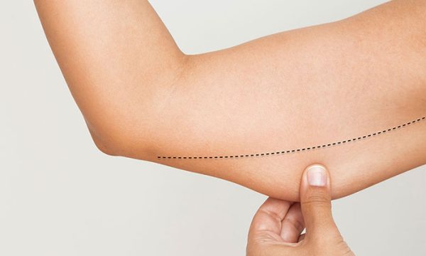 متى تظهر نتيجة شفط الذراعين