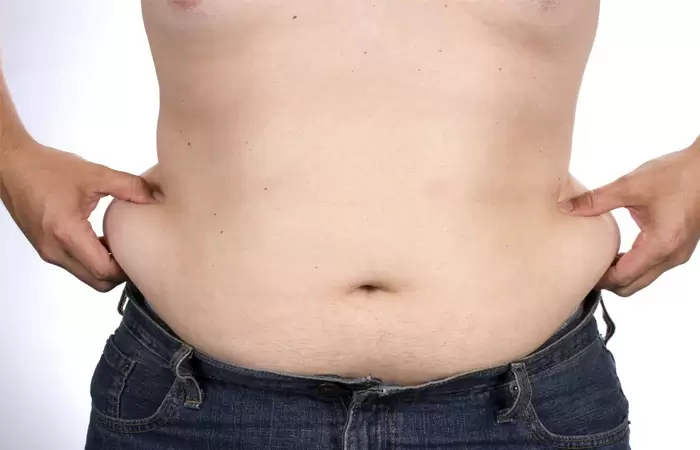 تقنية شفط الدهون بالفيزر