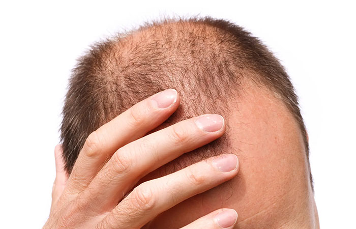 افضل مركز لزراعة الشعر