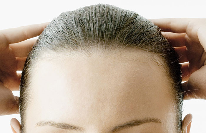 زراعة الشعر لتصغير الجبهة