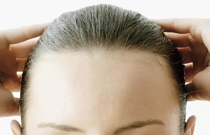 زراعة الشعر لتصغير الجبهة