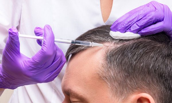 ابر البلازما بعد زراعة الشعر