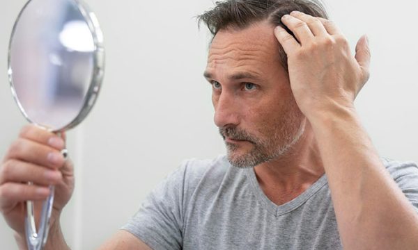 تعليمات بعد عملية زراعة الشعر