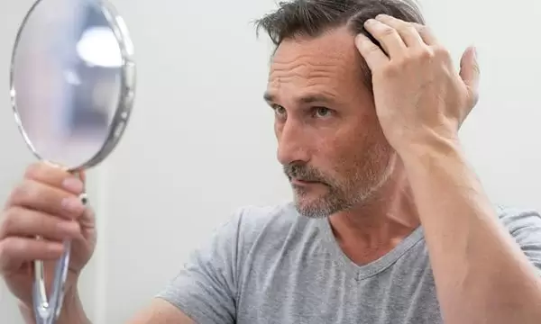 تعليمات بعد عملية زراعة الشعر