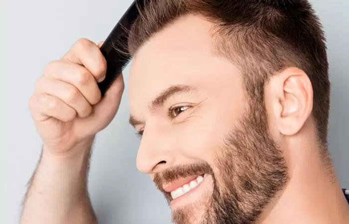زراعة الشعر في الأردن