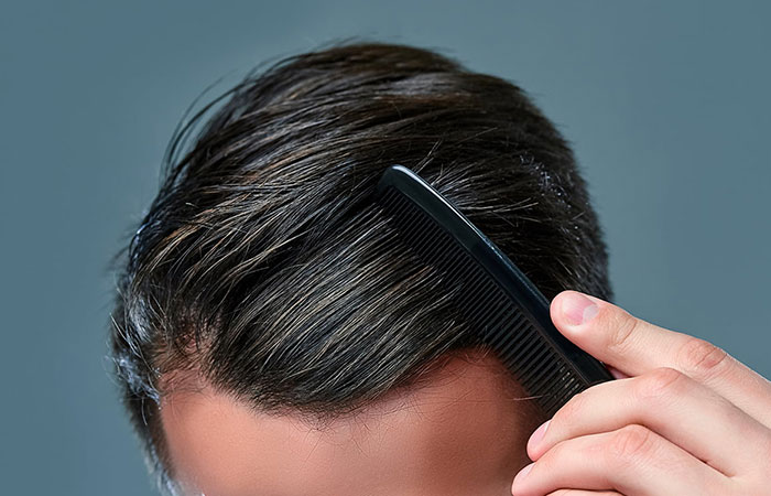 زراعة الشعر في الإمارات