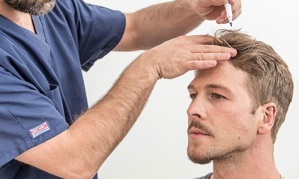 زراعة الشعر في تركيا