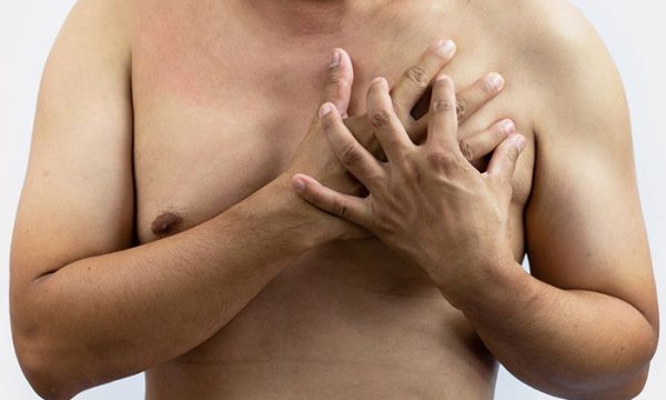 عملية تصغير الثدي للرجال