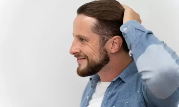 تغطية الرأس بعد زراعة الشعر