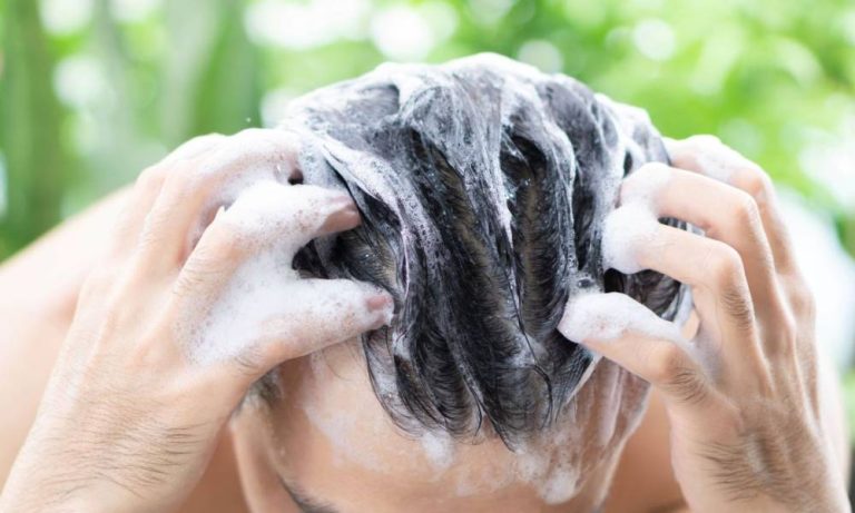 الممنوعات بعد زراعة الشعر